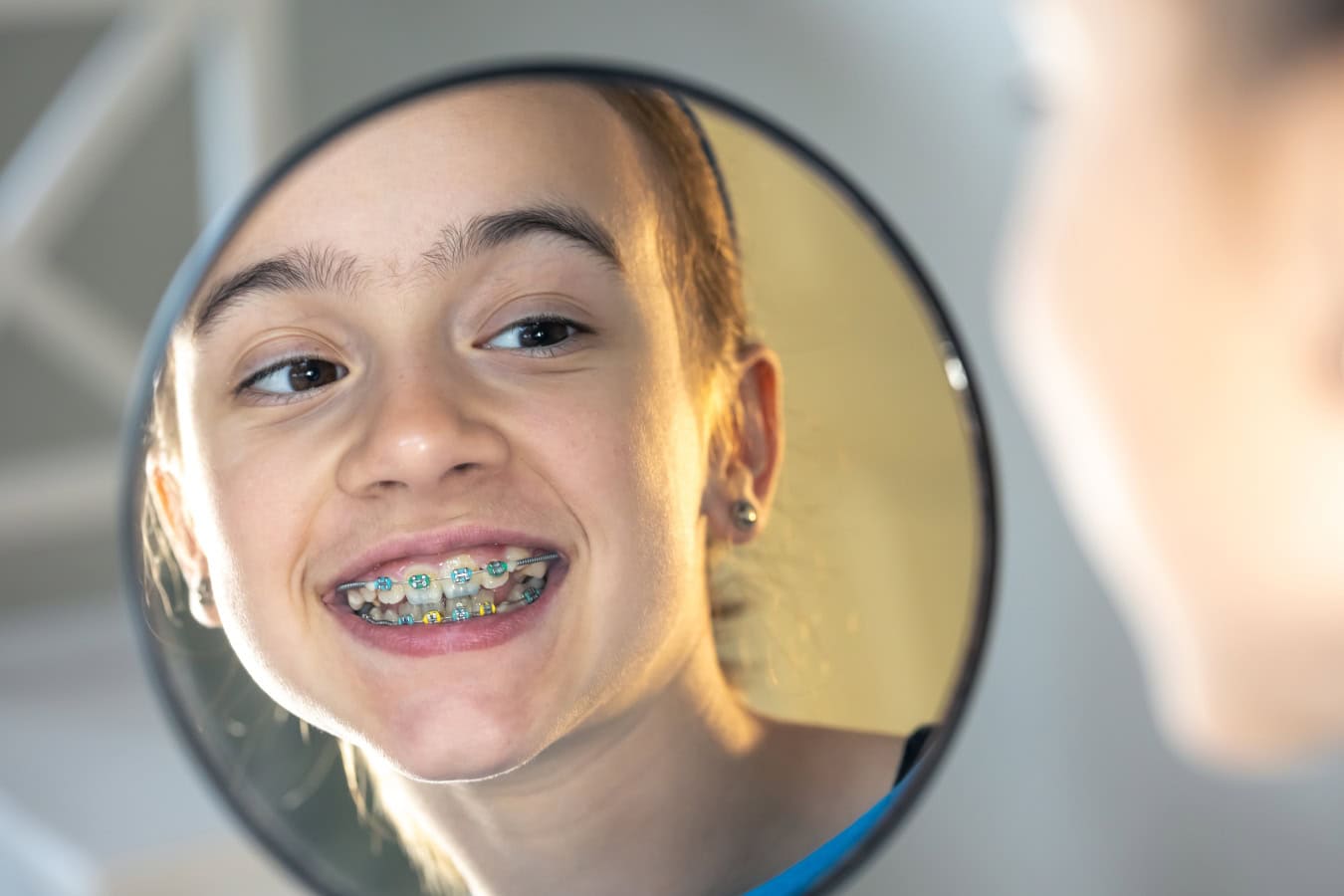 Ways to Tell if Your Child Needs Braces