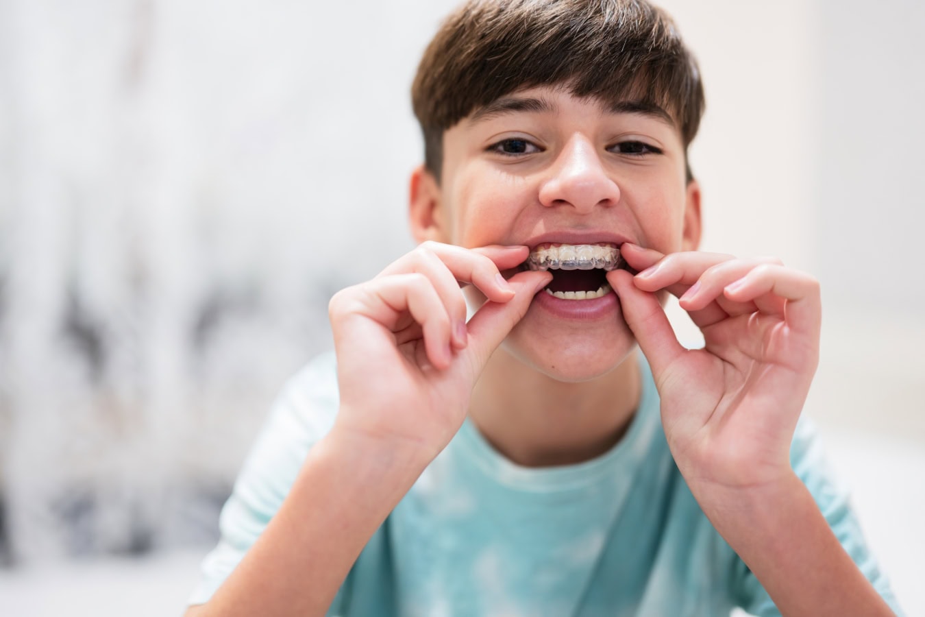 Invisalign First: Invisalign for Kids